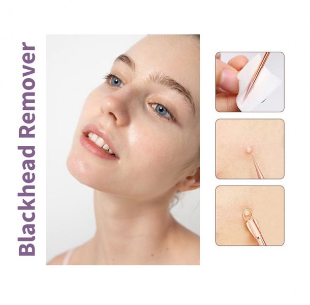 Інструменти косметичні для видалення вугрів MODAY Blackhead Remover 8 пристроїв 711 фото